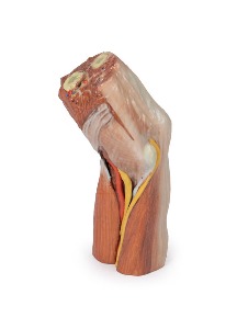 [MP1755] 주관절 근육 모형 - 3D 아나토미
